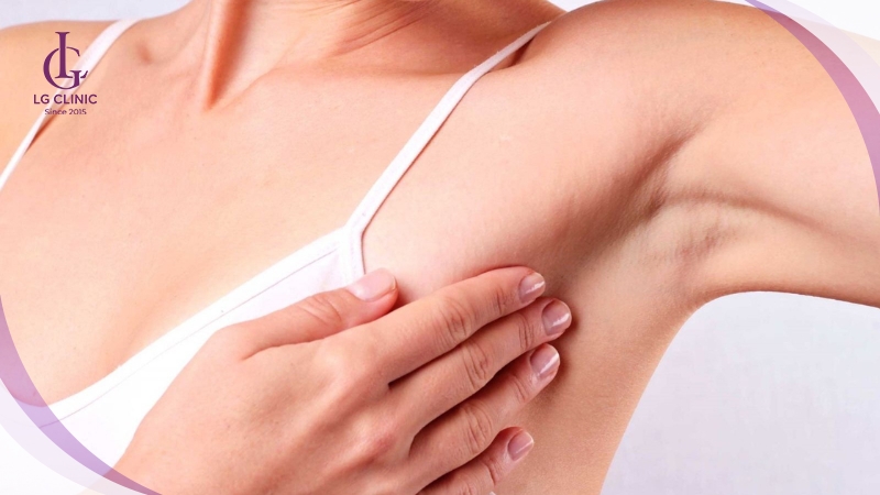Nhược điểm khi triệt lông nách bằng vôi