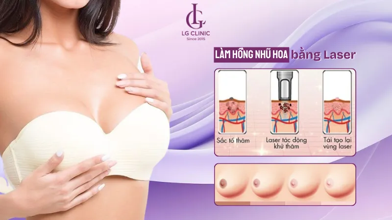 dịch vụ làm hồng nhũ hoa