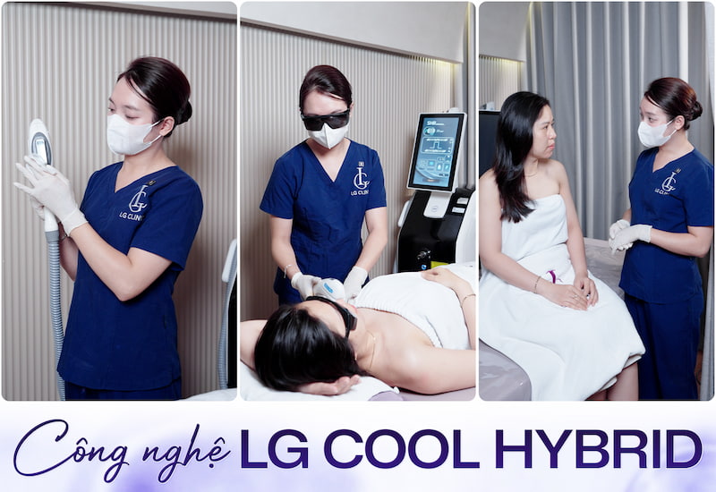 thời gian triệt lông phải cách nhau bao lâu