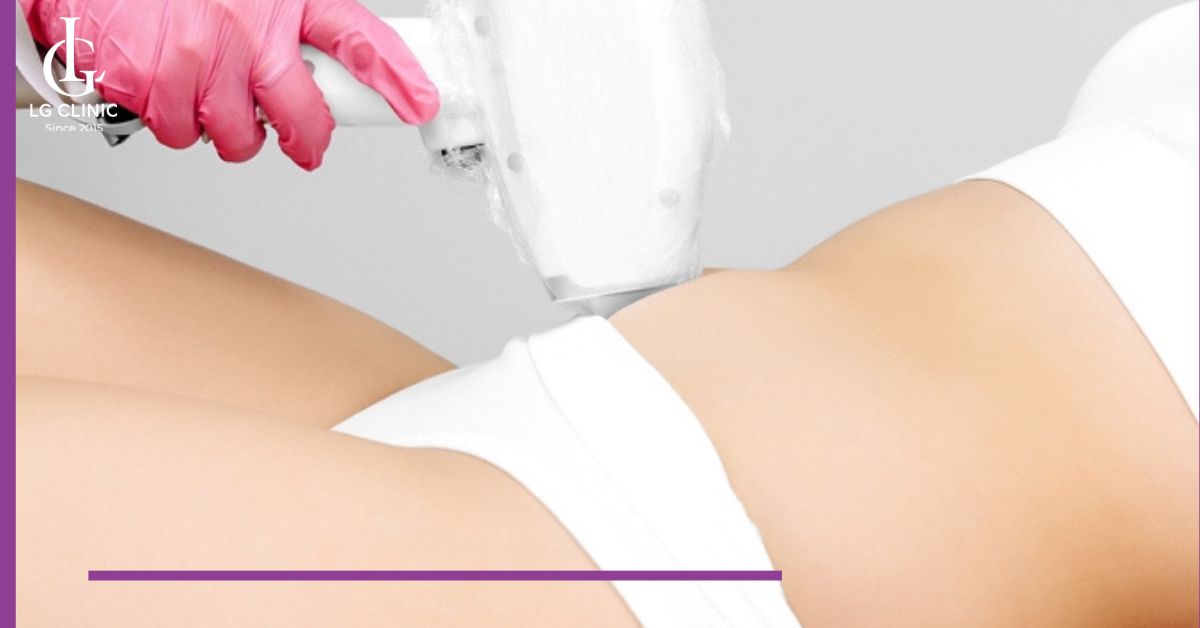 Quy trình triệt lông vùng viền bikini