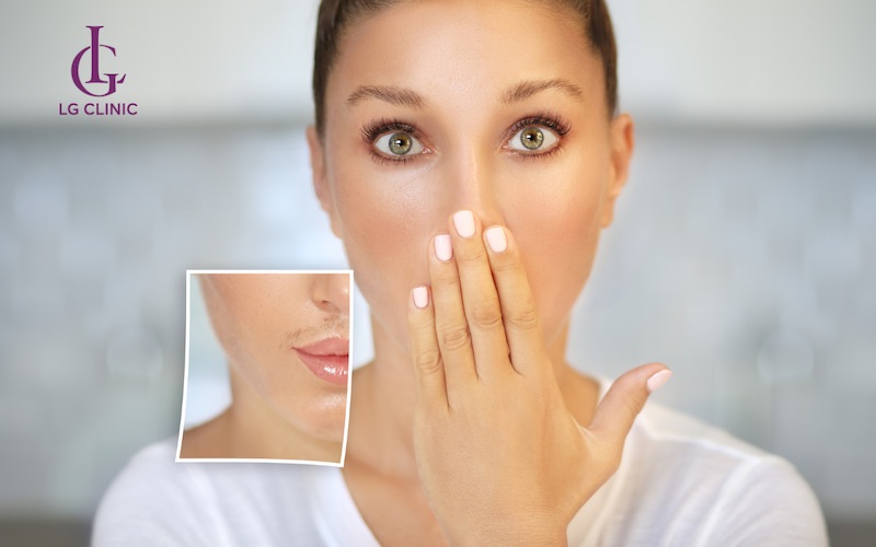 ria mép có tự rụng không