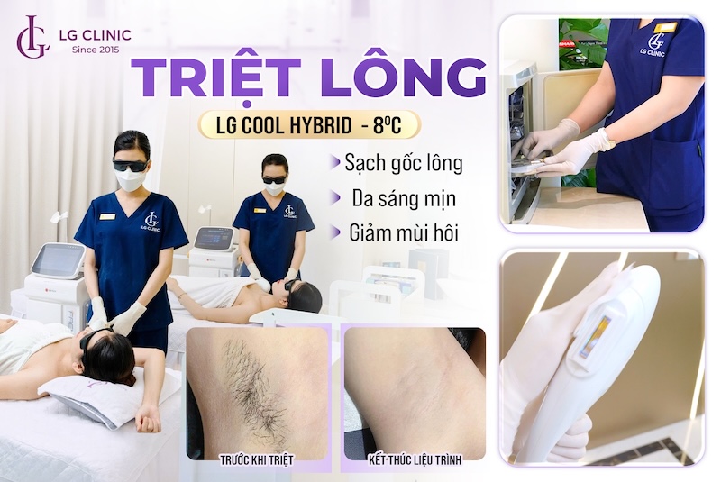 triệt lông LG Cool Hybrid