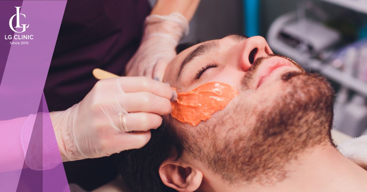 Tẩy lông mặt nam giới bằng sáp wax lông
