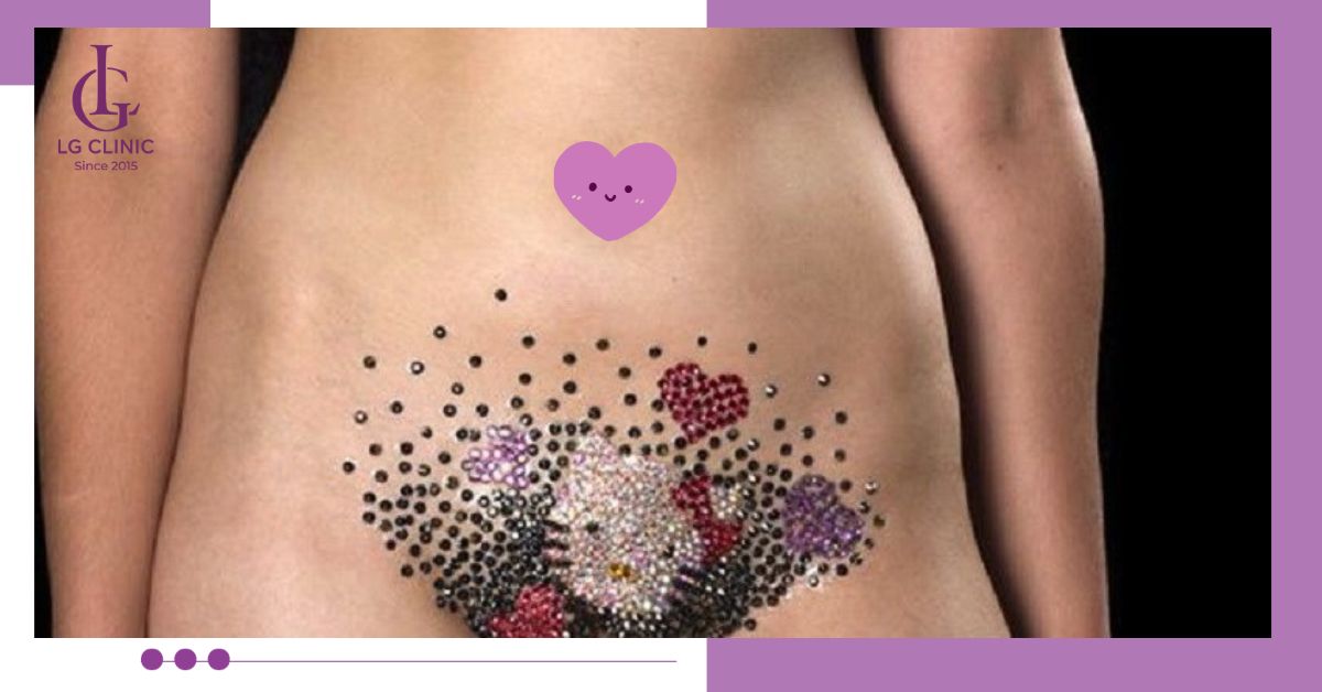 Thỏa sức sáng tạo với triệt lông tạo hình kiểu Vajazzle