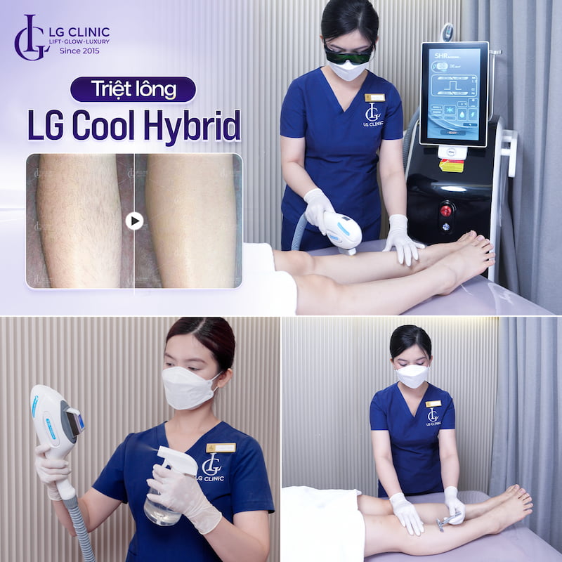cách triệt lông chân