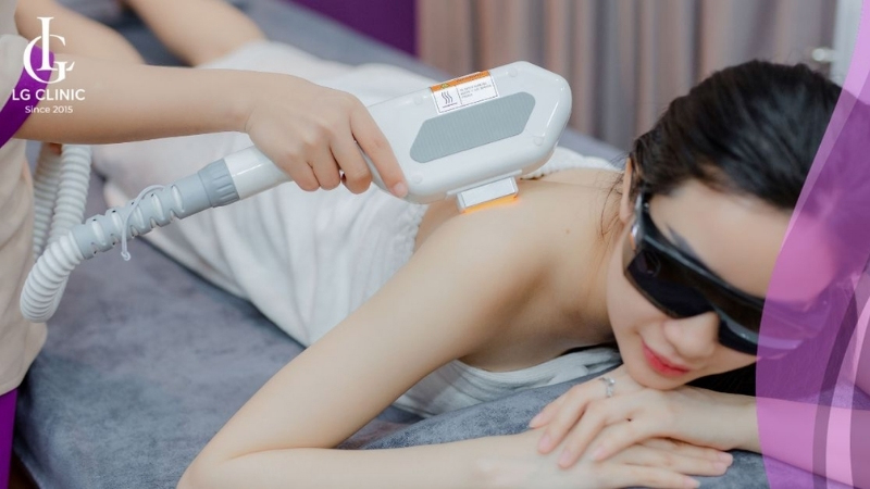 LG Clinic là địa chỉ triệt lông lưng uy tín