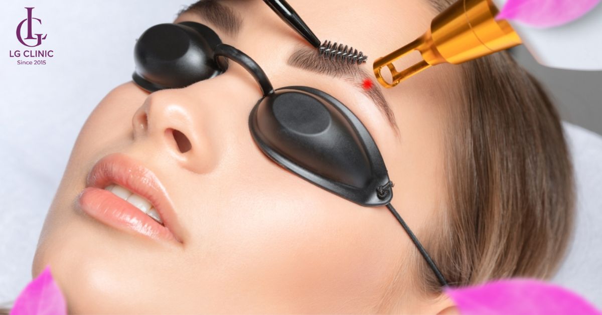 Triệt lông mày với công nghệ ánh sáng