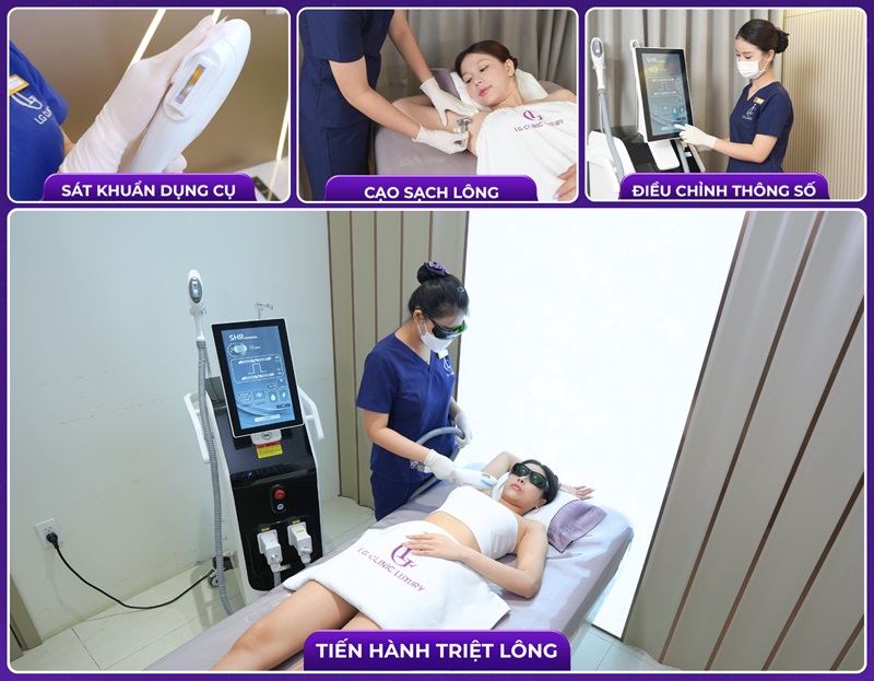 spa triệt lông uy tín tphcm