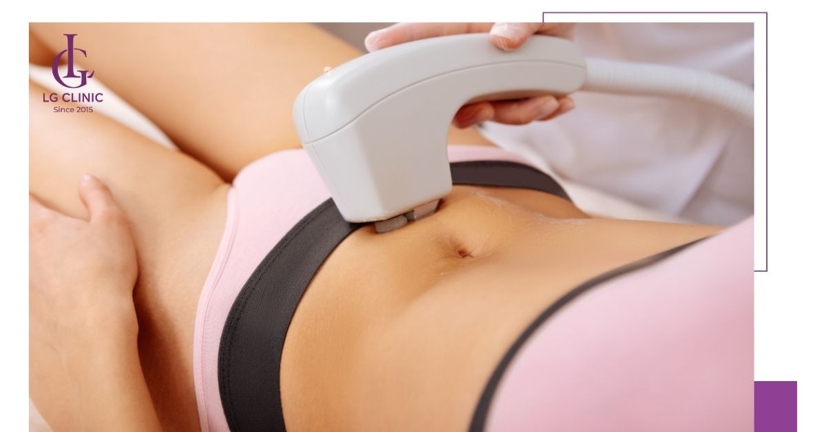 Triệt lông vùng kín bằng laser