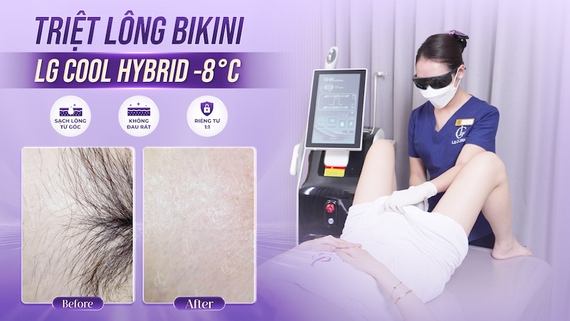 triệt lông bikini LG Cool Hybrid