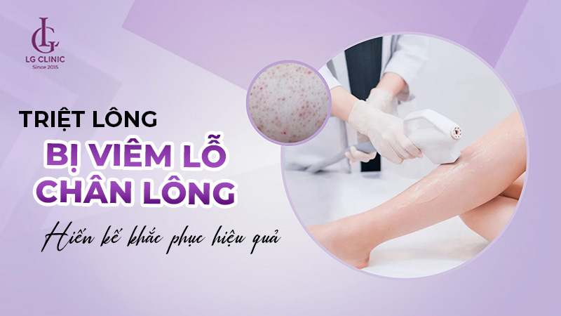 Triệt lông xong bị viêm lỗ chân lông