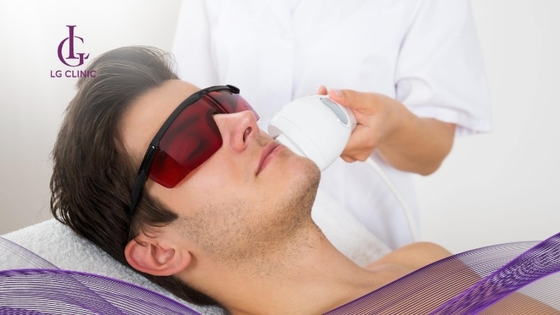 Triệt râu vĩnh viễn bằng công nghệ hiện đại