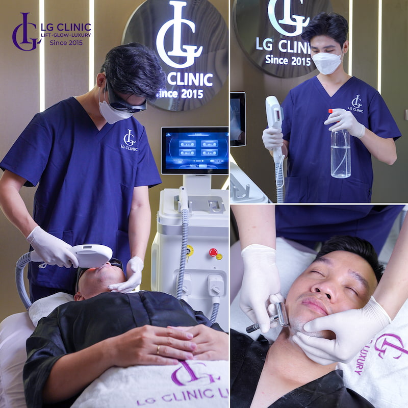 cách nhổ râu không mọc lại