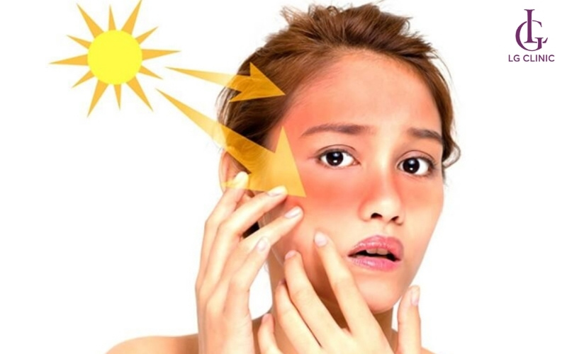 Tia UV cao khiến da bị cháy nắng nghiêm trọng