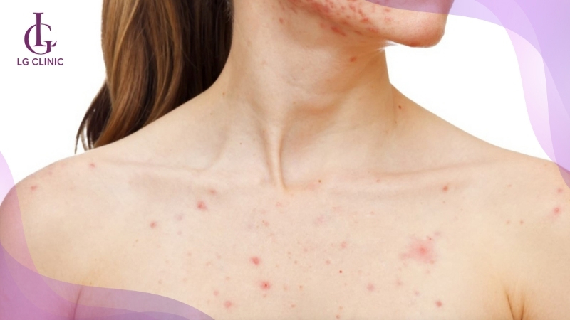 Da tổn thương không nên sử dụng đá mài tẩy lông