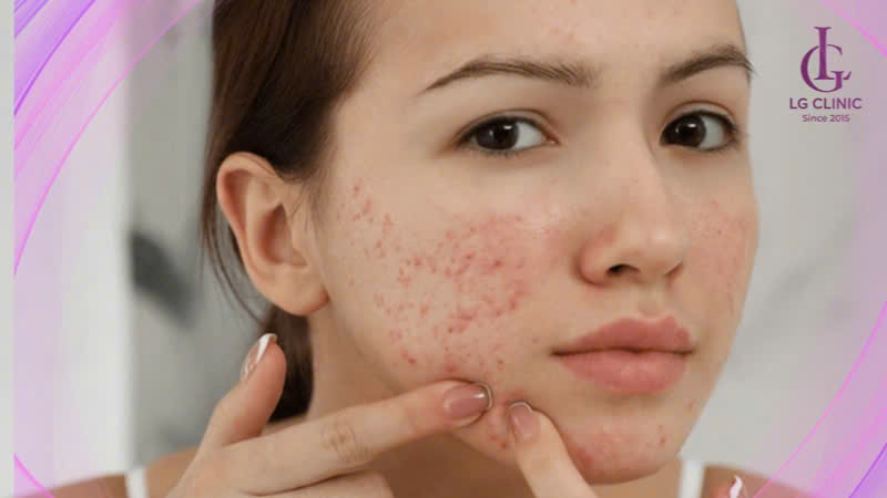 tác hại của kem trộn
