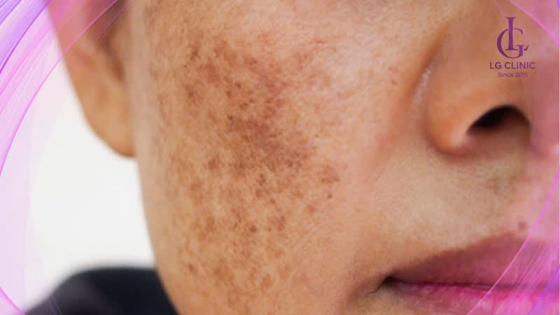 tác hại của kem trộn