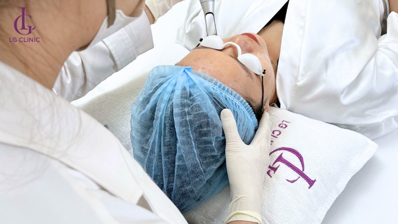 Laser trị thâm