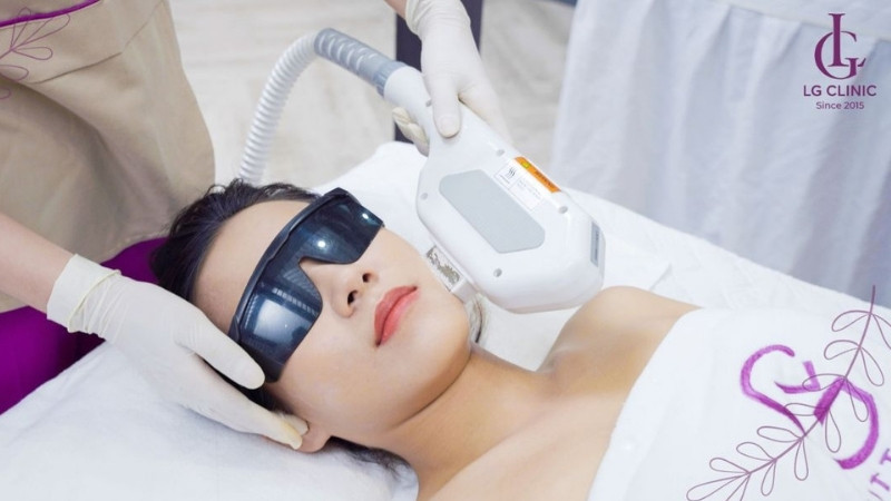 So sánh công nghệ LG Cool với cách triệt lông mặt tại nhà