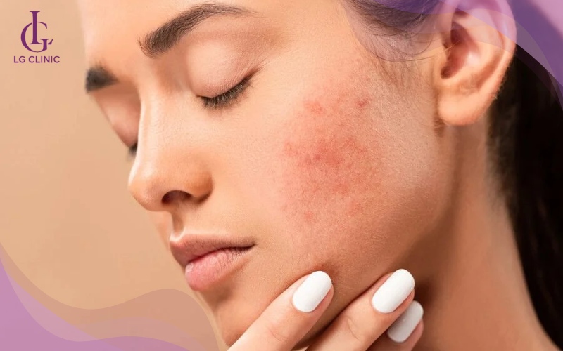 da mặt bị cháy nắng làm sao để trắng lại
