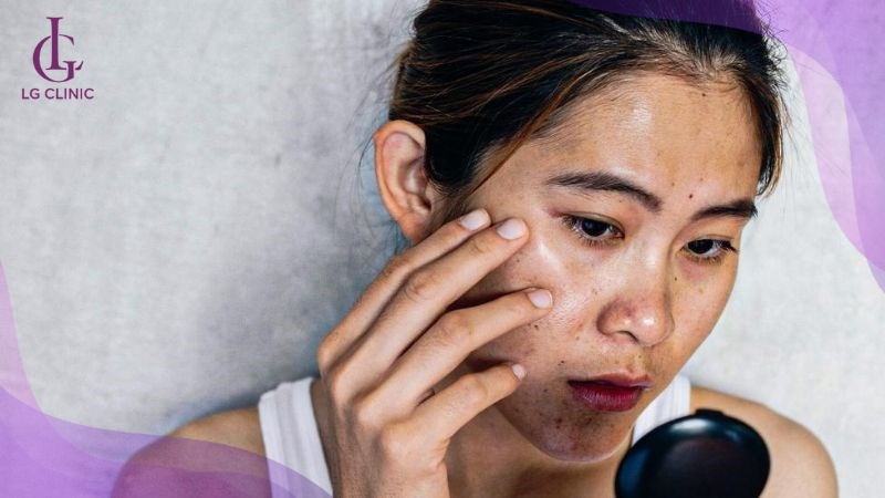 da mặt bị cháy nắng làm sao để trắng lại