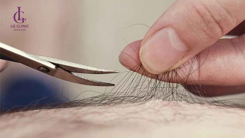 cách tỉa lông vùng kín tại nhà