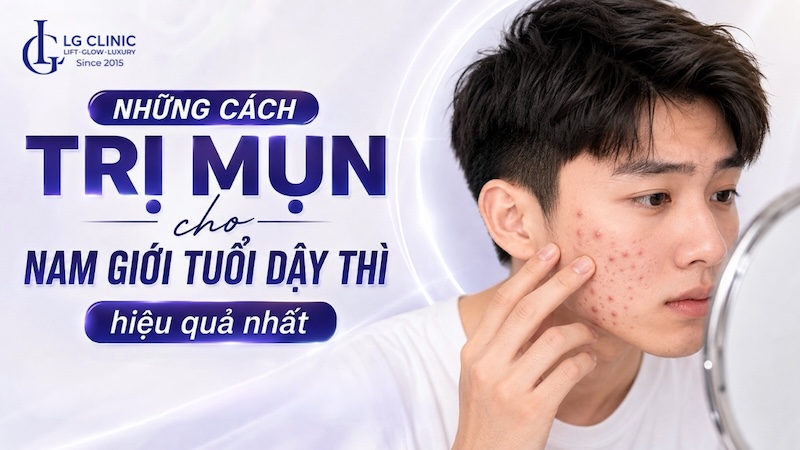 cách trị mụn cho nam giới tuổi dậy thì