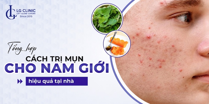 cách trị mụn cho nam tại nhà