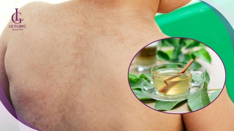 Tắm lá cây tự nhiên để làm rụng lông ở người lớn hiệu quả