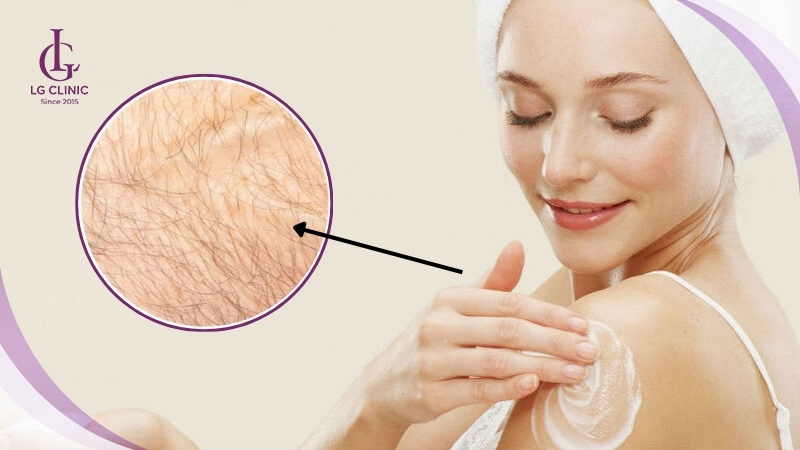 Tắm trắng bị vàng lông phải làm sao