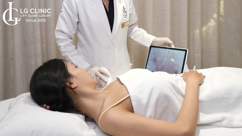 trị thâm nách bằng laser