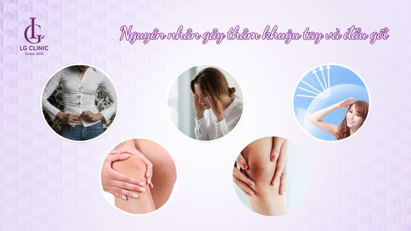 cách trị thâm khủy tay đầu gối