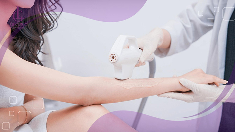 Công nghệ triệt lông OPT sử dụng ánh sáng xung ổn định để loại bỏ lông an toàn và hiệu quả.