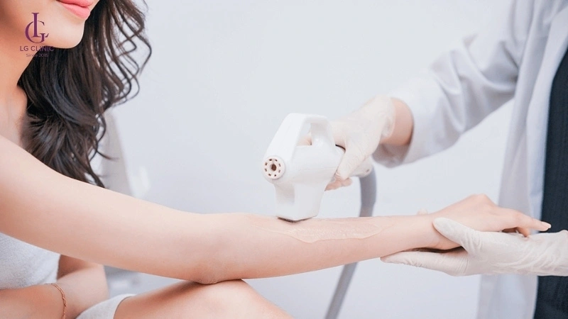 Dịch vụ triệt lông bằng công nghệ diode laser tại LG Clinic uy tín và an toàn
