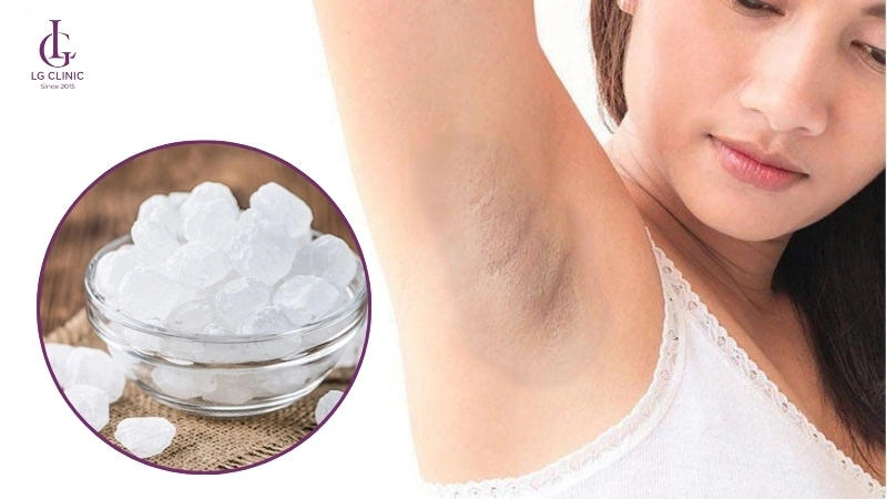 cách trị thâm nách bằng phèn chua