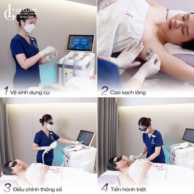 triệt lông lạnh