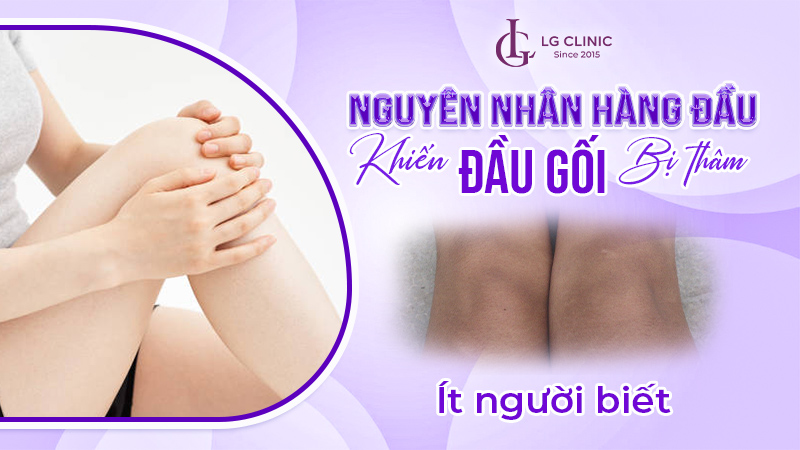 Tại sao đầu gối bị thâm