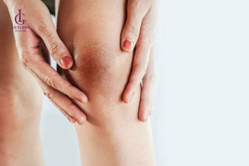 tại sao Đầu gối bị thâm