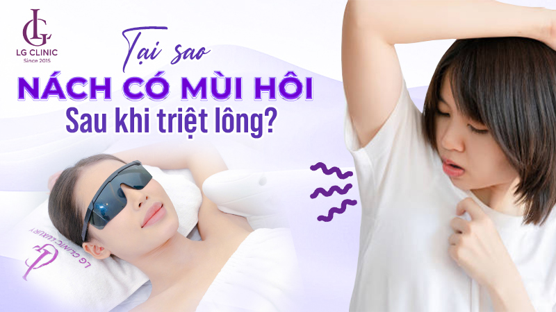 Tại sao triệt lông nách lại bị hôi nách