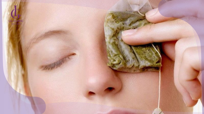 Đắp túi trà giảm thâm mắt - quầng thâm mắt thức khuya