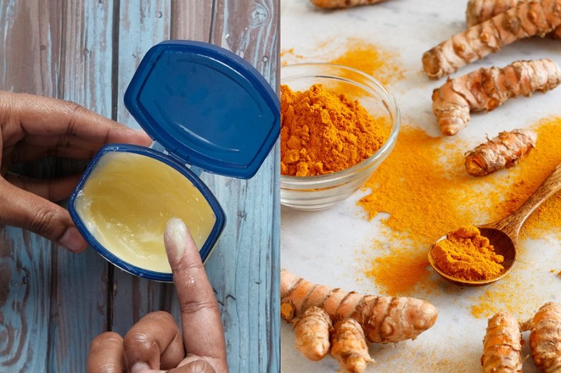 cách trị thâm mông bằng Vaseline và tinh bột nghệ