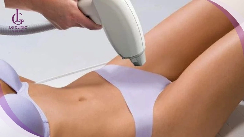 Triệt lông bằng công nghệ diode laser phù hợp mọi loại da