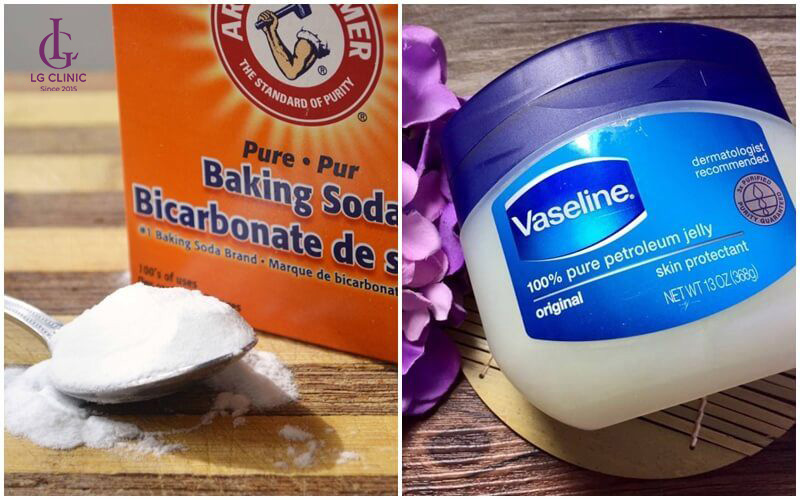 trị thâm đầu gối bằng Vaseline và Baking soda