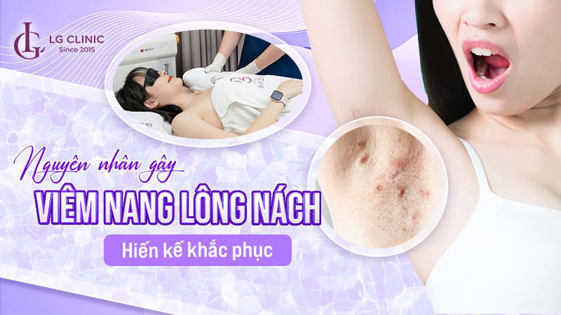 Viêm nang lông nách