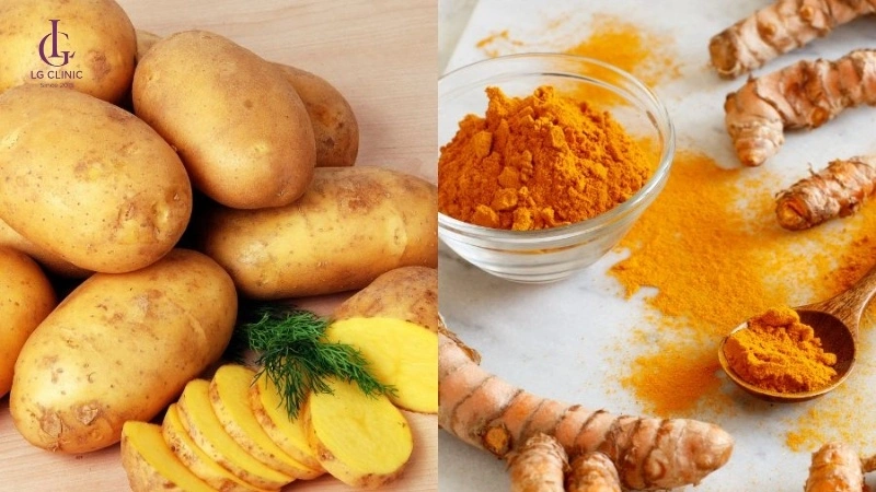 trị thâm vùng kín bằng khoai tây và bột nghệ