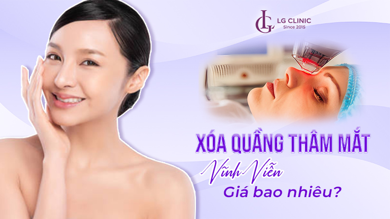Xoá quầng thâm mắt vĩnh viễn giá bao nhiêu