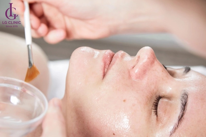 cách trị thâm đỏ sau mụn