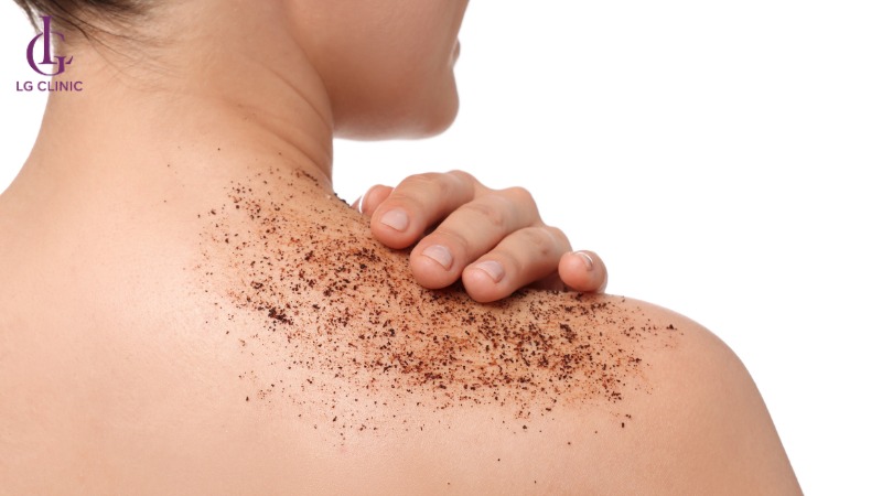 cách trị thâm mụn lưng