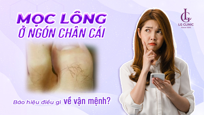Lông ngón chân cái