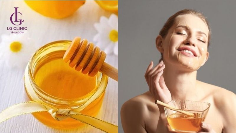 bôi mật ong sau khi nặn mụn để không thâm